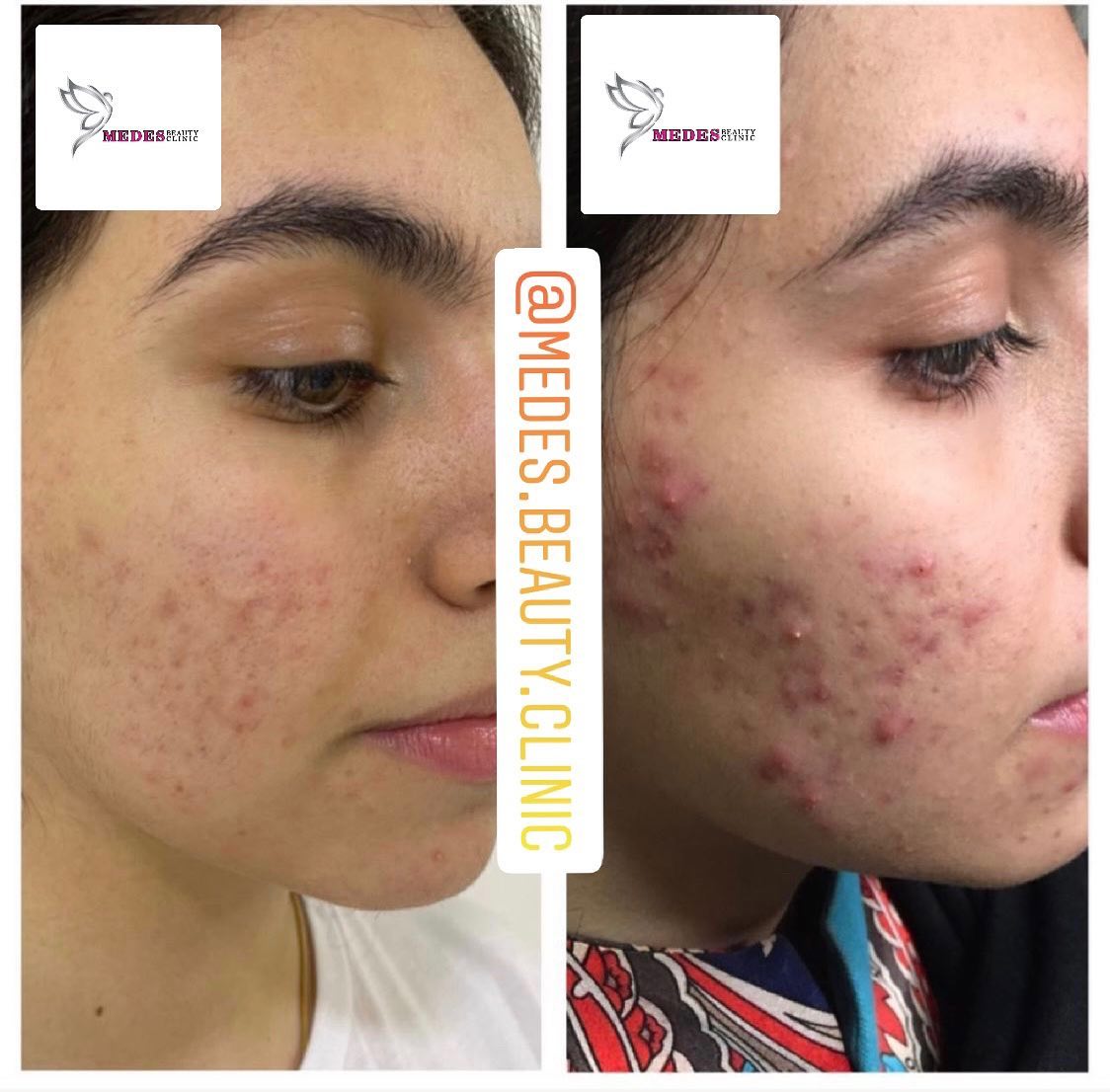 گالری مزونیدلینگ